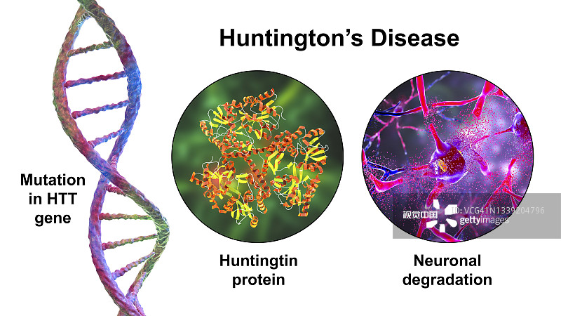 亨廷頓氏病，概念性說明