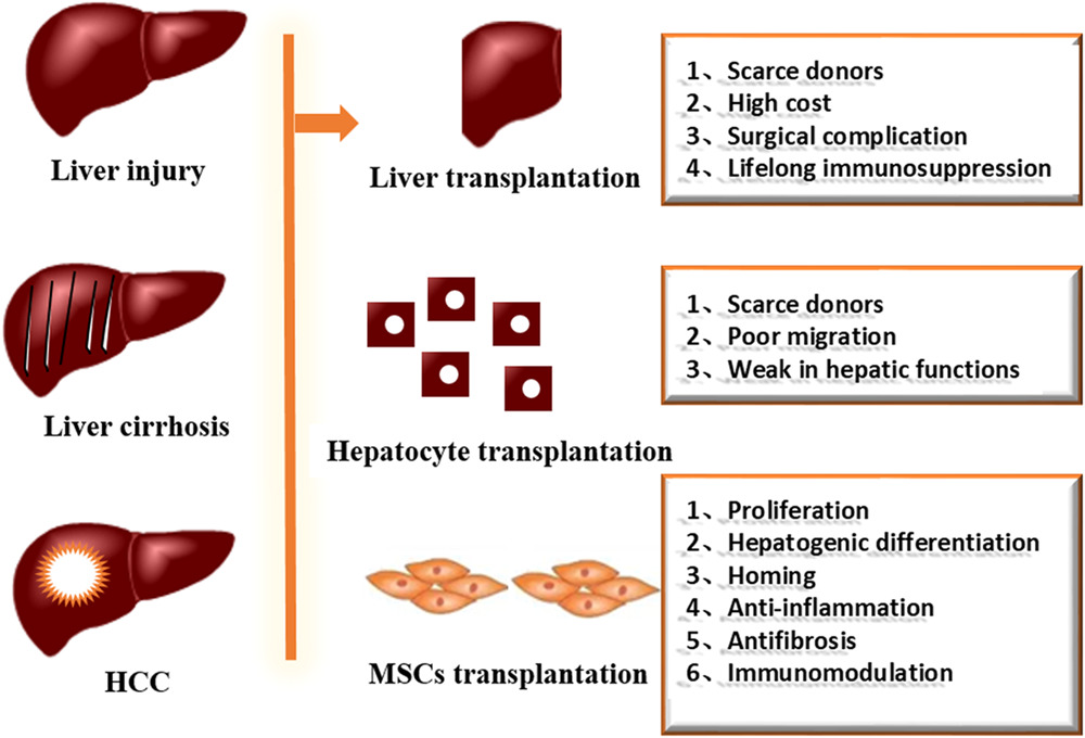 間充質(zhì)干細(xì)胞治療肝損傷的臨床研究進(jìn)展