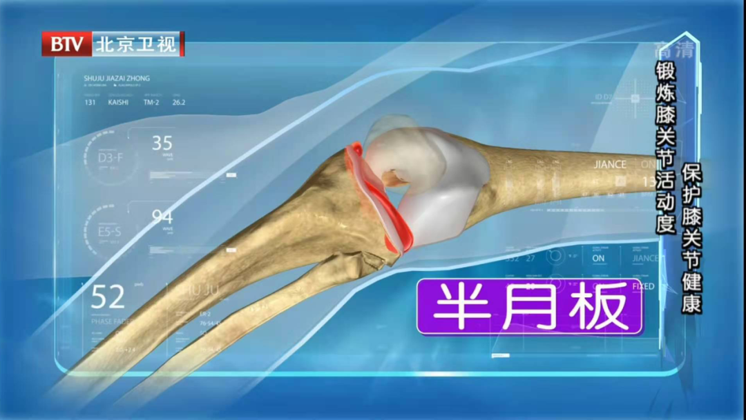 干細(xì)胞治療半月板損傷臨床試驗患者招募！