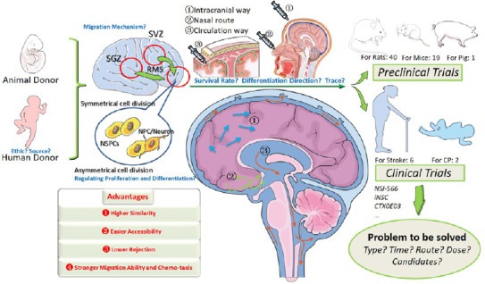 神經(jīng)干細(xì)胞移植治療中風(fēng)的臨床試驗(yàn)的步驟和挑戰(zhàn)