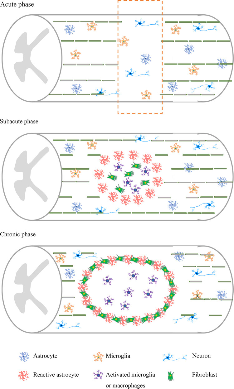 圖1：脊髓損傷不同階段的病理特點(diǎn)。