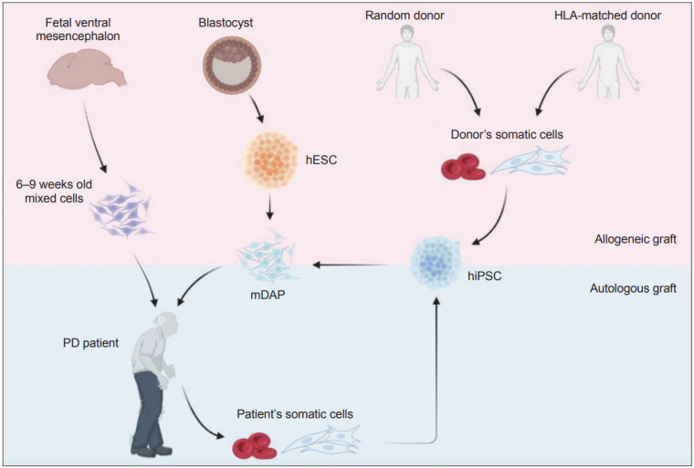 圖1：帕金森病 (PD) 細(xì)胞替代療法的潛在細(xì)胞來源比較。