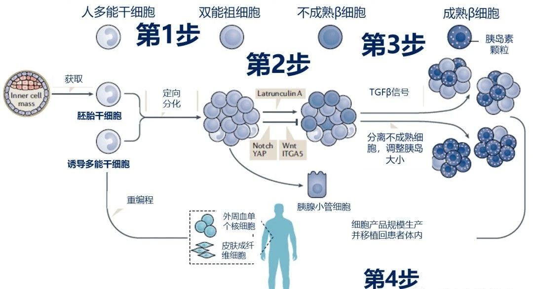 干細(xì)胞治療糖尿病的原理和機(jī)制