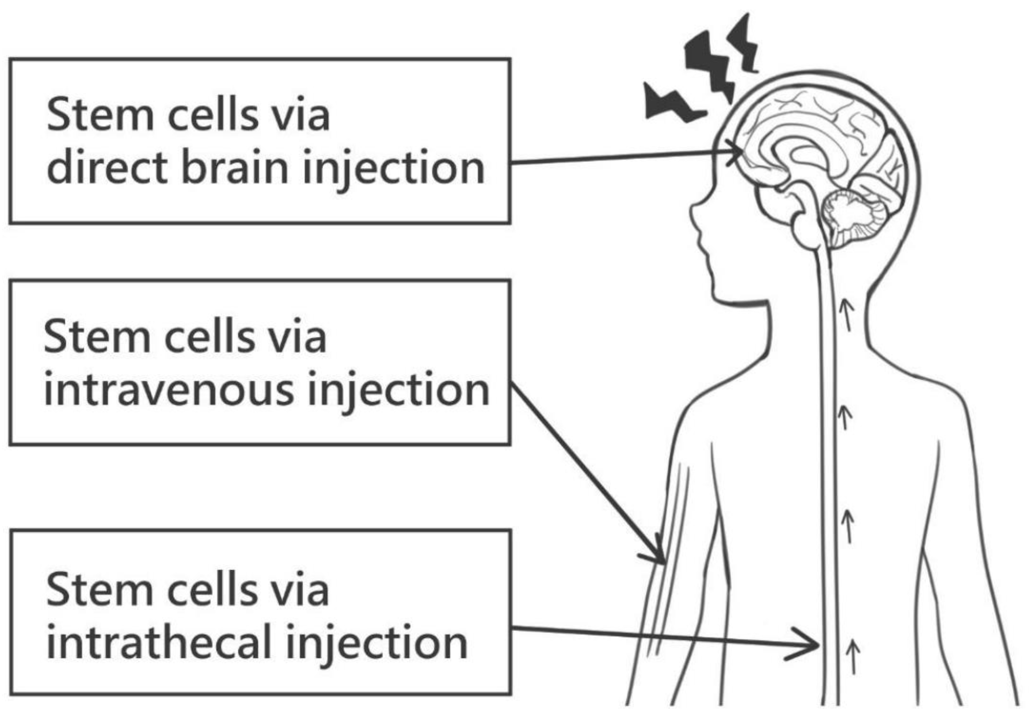 圖1：干細(xì)胞給藥的各種途徑。這些可能包括直接腦注射、靜脈注射和鞘內(nèi)注射。