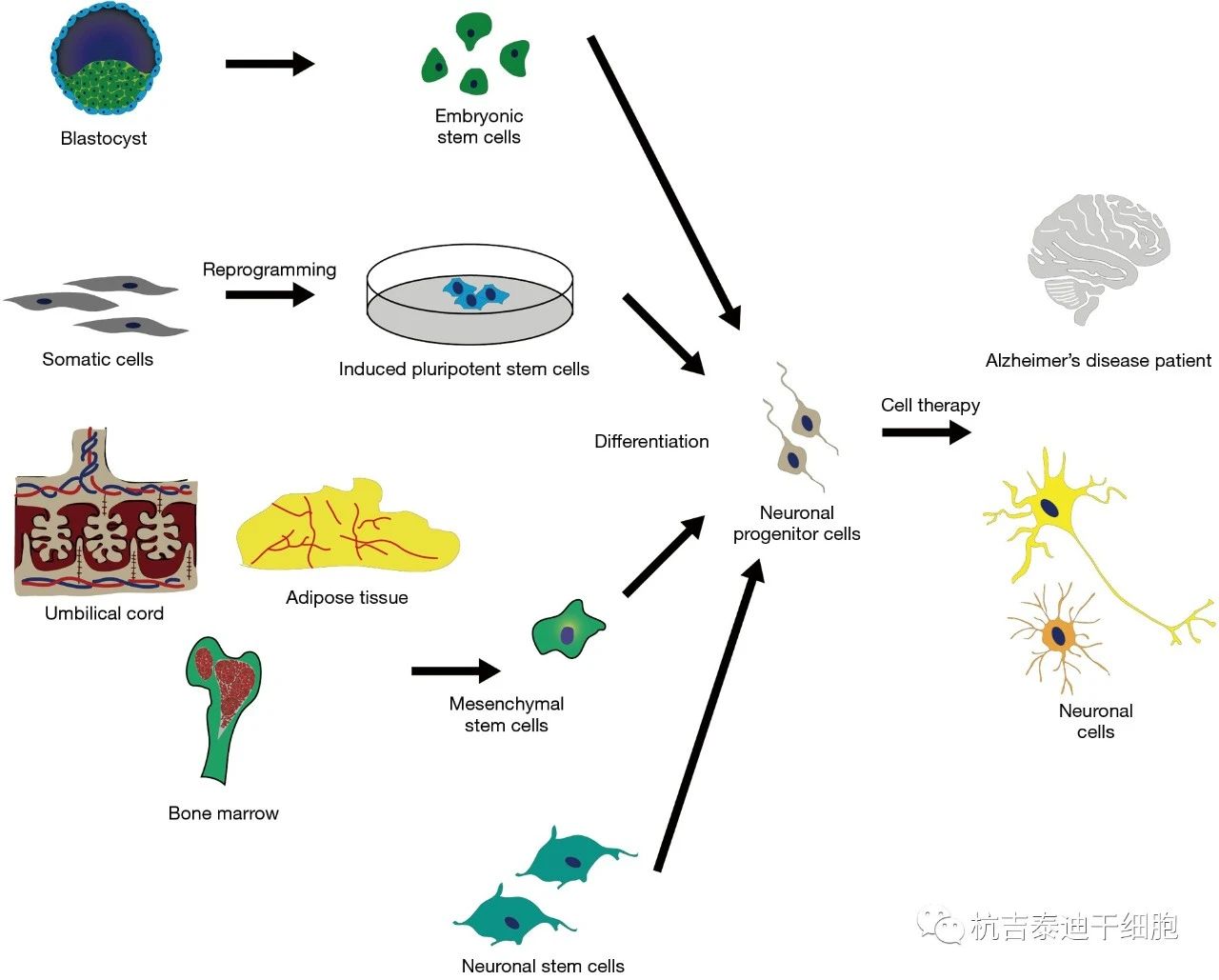 圖1：干細胞療法起源于目前用于治療阿爾茨海默病的各種來源。