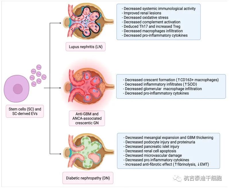 干細(xì)胞和EV作為原發(fā)性腎小球腎炎的治療工具