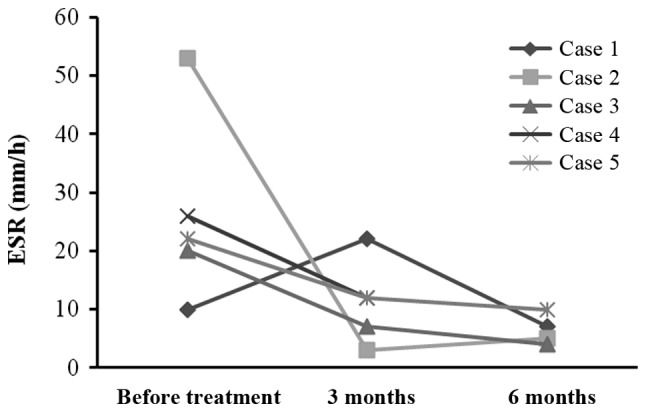 圖3:每位患者在治療前后的ESR。3例患者血沉明顯下降