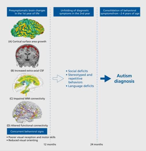 圖1：在出現(xiàn)典型自閉癥譜系障礙之前，自閉癥譜系障礙的可觀察大腦特征癥狀