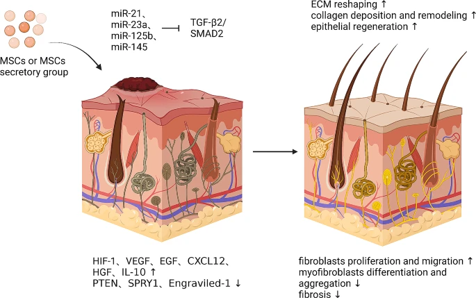 圖6：間充質(zhì)干細(xì)胞促進(jìn)皮膚疤痕修復(fù)的機(jī)制。