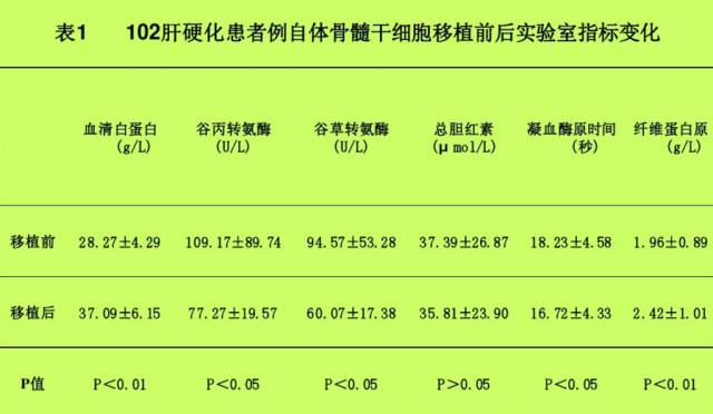 自體骨髓干細(xì)胞移植治療肝硬化102例報(bào)告。