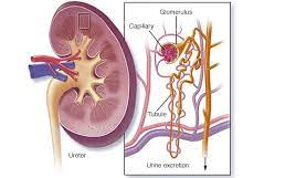 狼瘡性腎炎的診斷方法