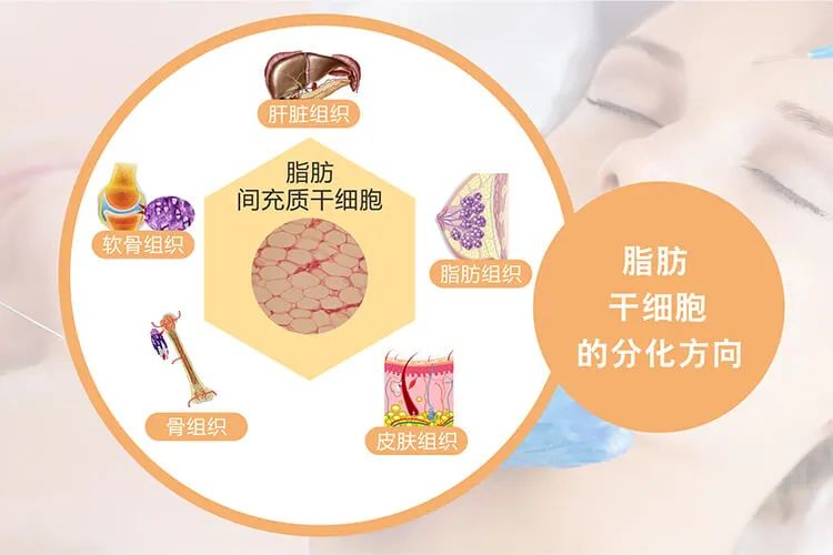 什么是脂肪干細(xì)胞：脂肪干細(xì)胞來源、臨床應(yīng)用