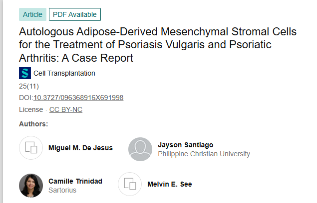 《自體脂肪來源的間充質(zhì)基質(zhì)細胞治療尋常型銀屑病和銀屑病關(guān)節(jié)炎：病例報告》
