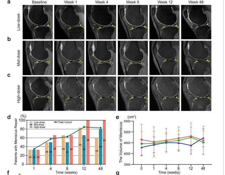 a – c不同劑量組膝關(guān)節(jié) MRI 掃描中的半月板損傷。d半月板修復(fù)患者百分比。e注射后六個時間點(diǎn)的半月板體積分析。