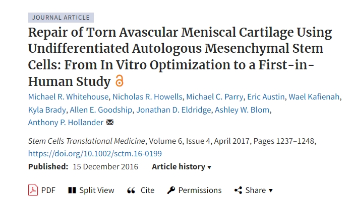 使用未分化自體間充質(zhì)干細(xì)胞修復(fù)撕裂的無血管半月板軟骨：從體外優(yōu)化到首次人體研究