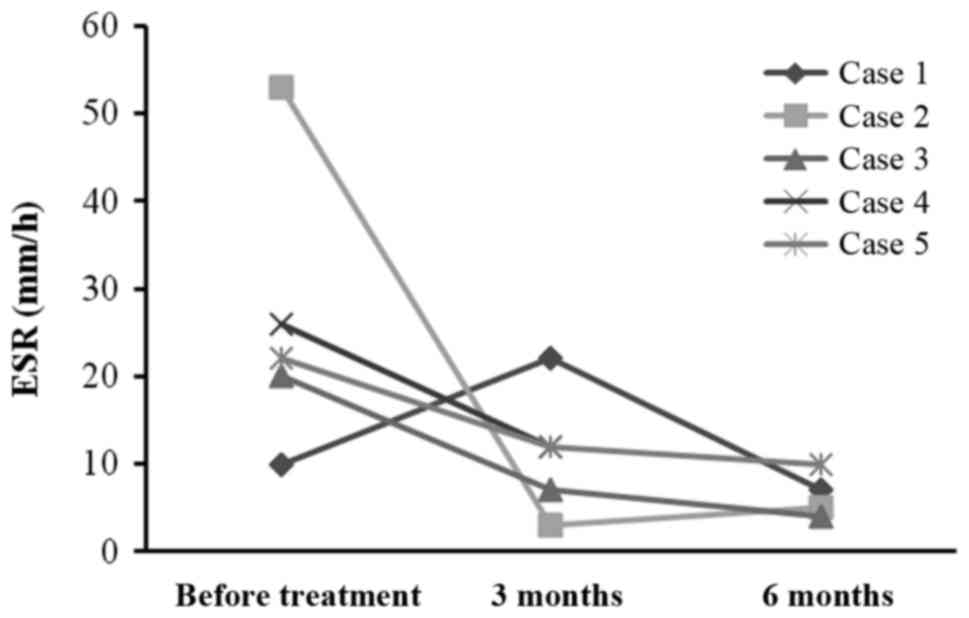 每位患者治療前后的 ESR。3 位患者的 ESR 明顯下降。ESR，紅細胞沉降率。