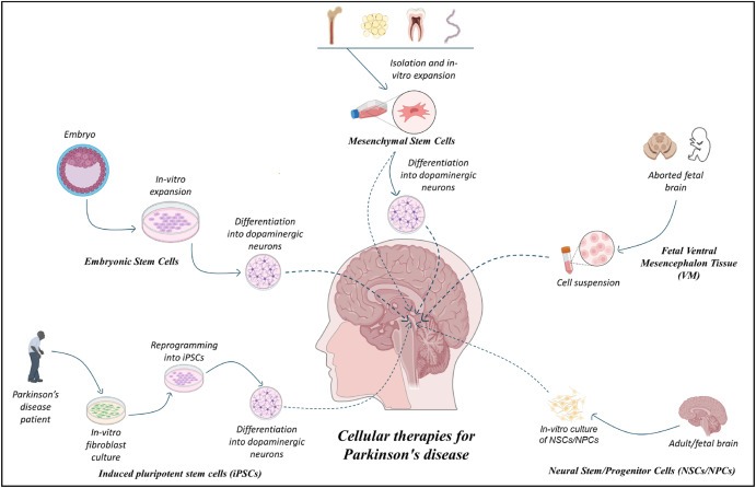 圖1：帕金森病的細胞療法：胚胎干細胞 (ESC)、誘導性多能干細胞 (iPSC)、間充質(zhì)干細胞 (MSC)、神經(jīng)干細胞/祖細胞 (NSC/NPS) 是帕金森病的新興候選藥物。