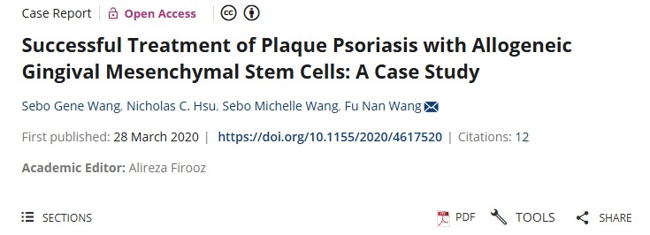 用同種異體牙齦間充質(zhì)干細(xì)胞成功治療斑塊狀銀屑病：案例研究