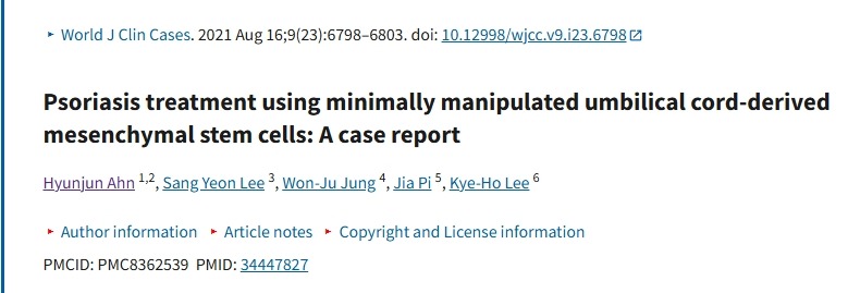 使用微操作臍帶來(lái)源的間充質(zhì)干細(xì)胞治療銀屑?。翰±龍?bào)告