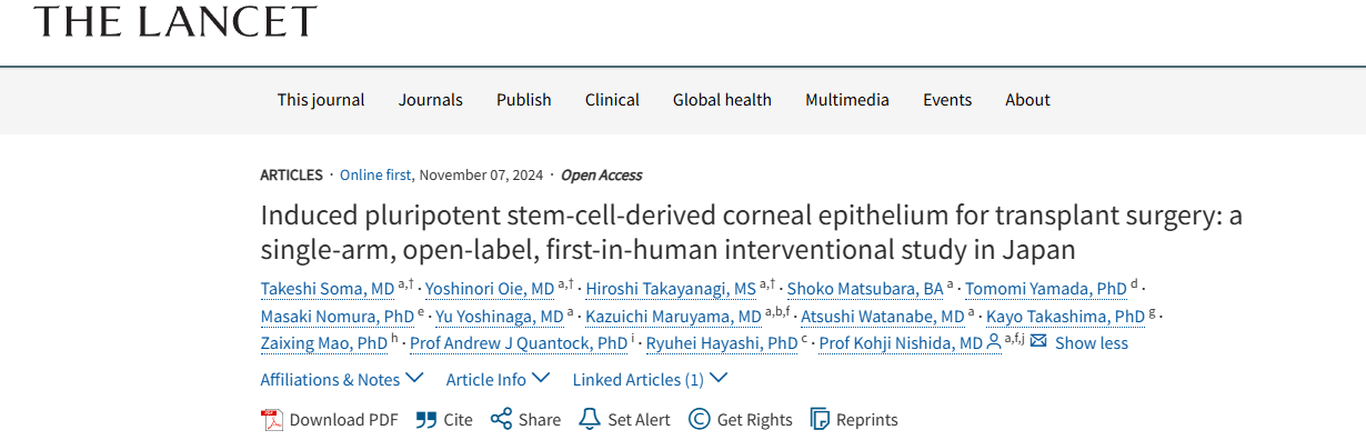 《誘導(dǎo)性多能干細(xì)胞來源的角膜上皮用于移植手術(shù)：日本的一項單臂、開放標(biāo)簽、首次人體介入研究》