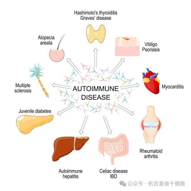 自身免疫性疾病的種類