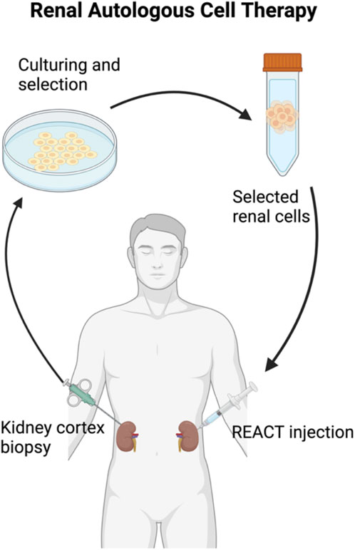 圖2：自體細胞治療腎臟疾病